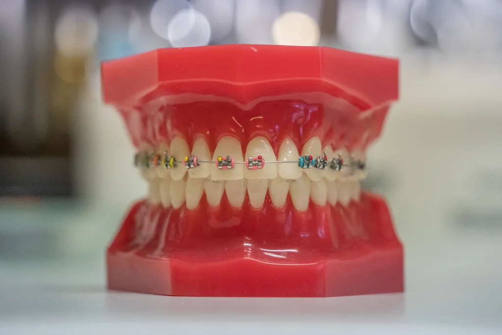 Conseils et astuces orthodontie